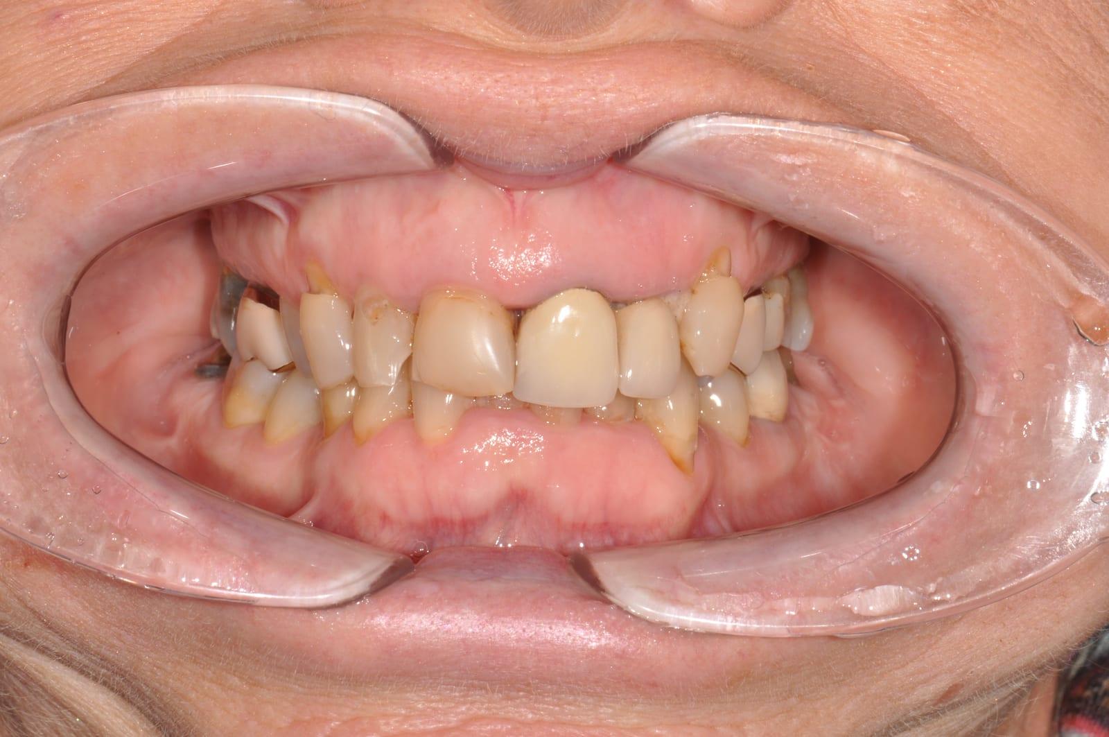 Sorriso prima
